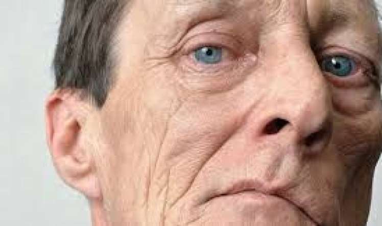 Mikro-insultun 5 təcili əlaməti - Hər kəs yoxlansın