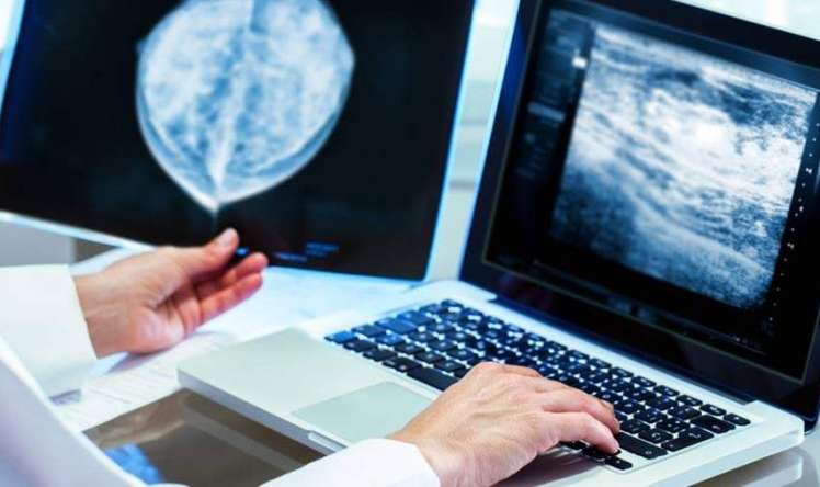 Süd vəzi xərçəngini dəqiq göstərən müayinə 