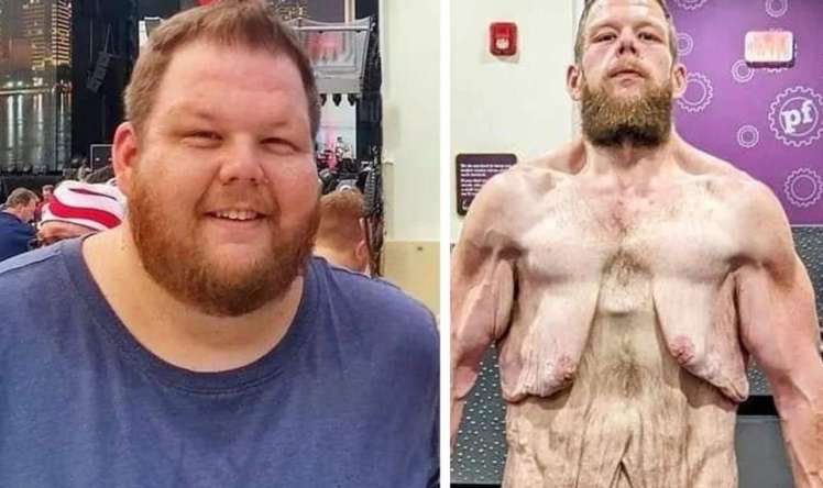 163 kilo arıqladı -  Görənləri şok etdi