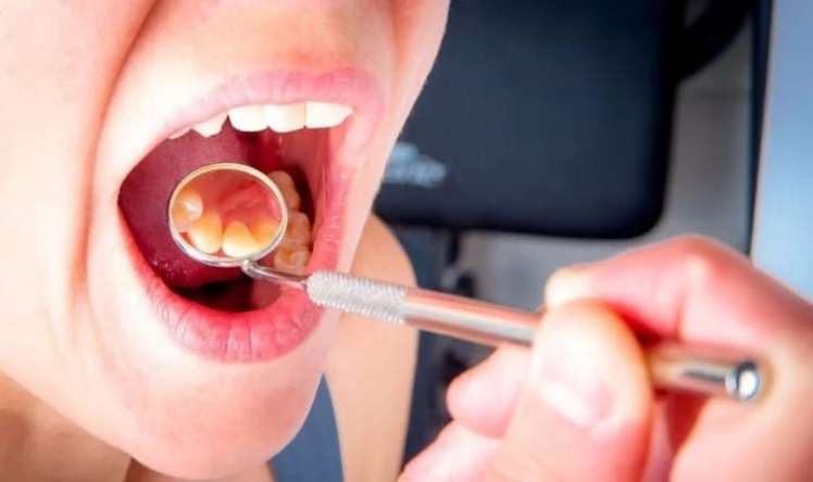 Şişən damaqlara diqqət:  Etdiyiniz səhv budur