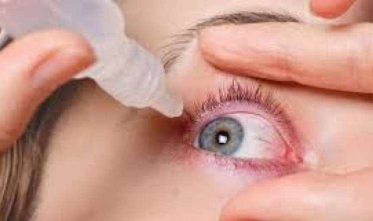 Gözlərin quru və yorğun olmasının    7 əlaməti