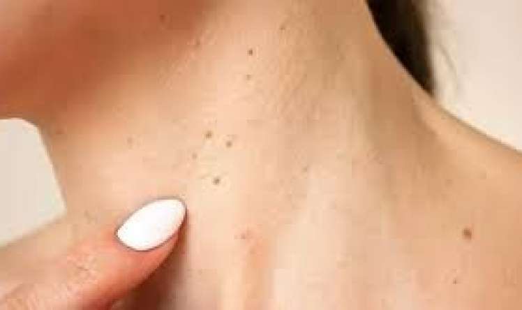 Bu simptomu ciddiyə almayanlar    peşman olur