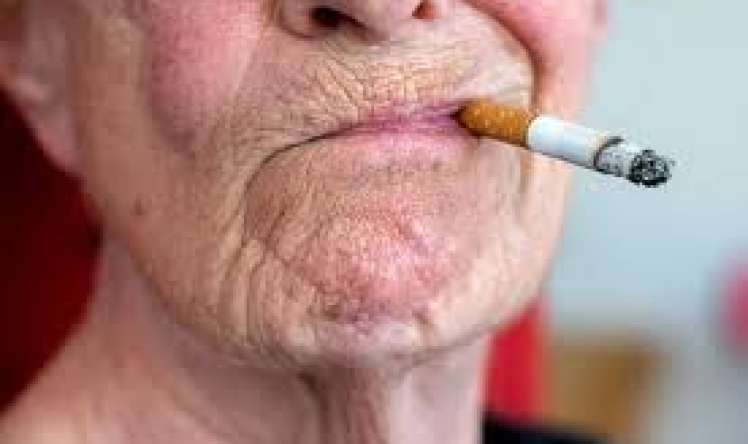 Nənənin siqaret çəkməsi nəvədə autzim yarada bilər  – ŞOK