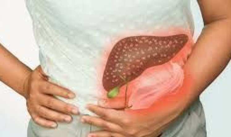 Yaşadığımız yer qaraciyər sirrozu    yarada bilər