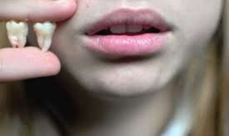 Ağıl dişi ilə insanın “ağlı” arasında əlaqə varmı? 