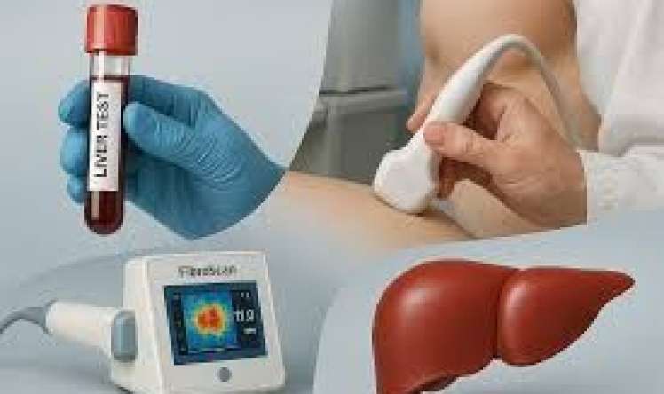 Qaraciyər sirrozu: hansı analiz və müayinələr vacibdir? 