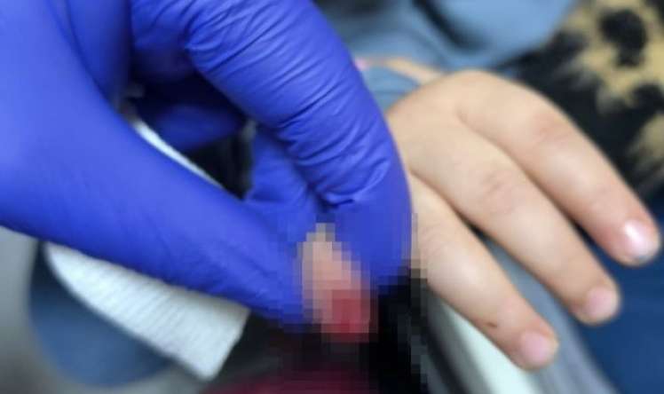 3 yaşlı uşağın əli eskalatorda qaldı -  Barmağı kəsildi