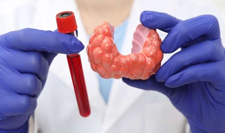 25 yaşlı qadına radioaktiv yod tövsiyə edildi -  İnteqrativ müalicə ilə əməliyyatsız nəticə əldə olundu