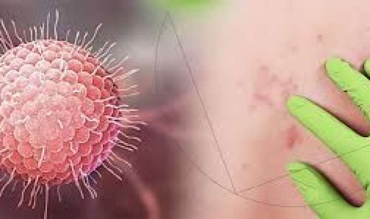 Bu virus bədəndə on illərlə yaşaya    bilər