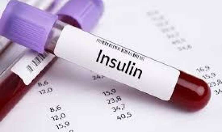 İnsulin 14-dən yuxarıdır    - Bu nə deməkdir?