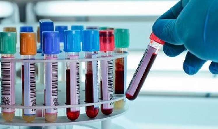 İşə qəbulda narkoloji rəy  təqdim ediləcək