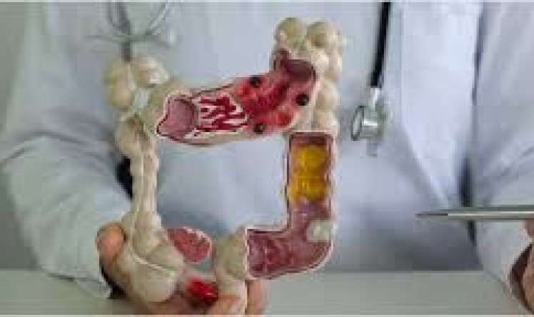 Bədəndə xoşxassəli düyünlər niyə yaranır?  