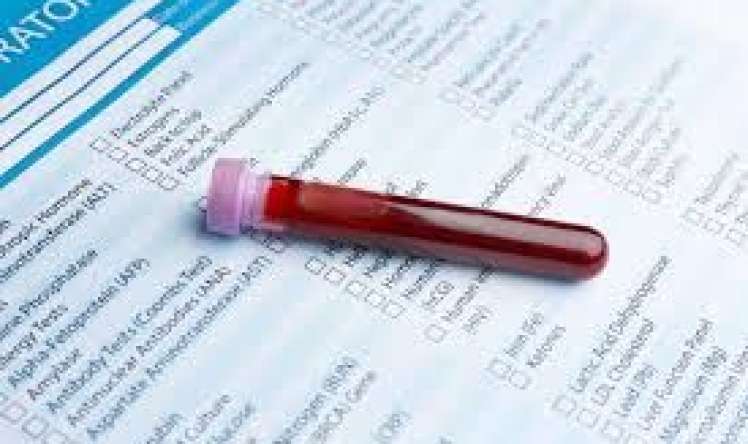  Azərbaycanda heç kim yoxlatmır - Ən vacib gizli analiz