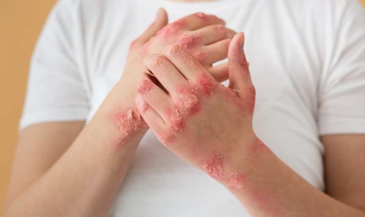 Bu 2 siqnal  varsa  – Səndə B9 çatışmır