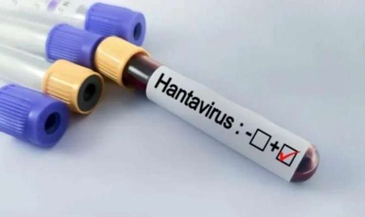 Hantavirus hansı ölkələrdə aşkarlanıb? -  Yoluxma artır