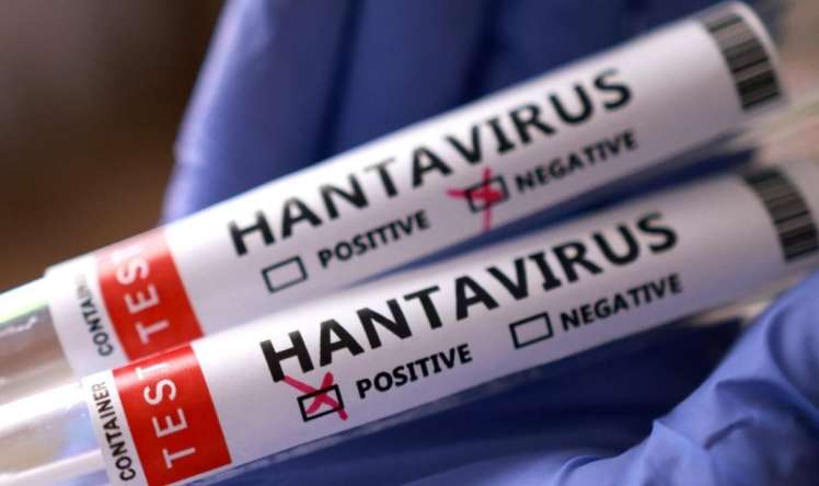 Hantavirus COVID-19-dan  təhlükəlidir?