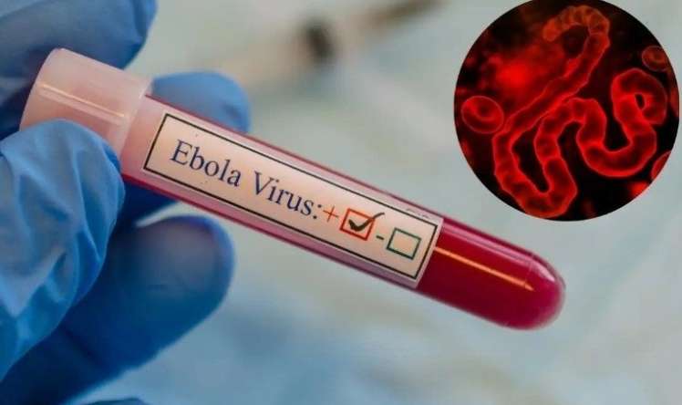 Ebola virusundan 139 nəfər ölüb - RƏSMİ