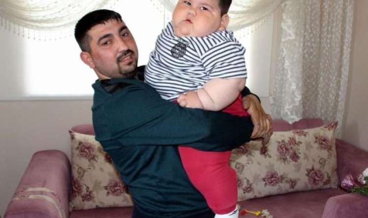 5 yaşında 90 kilo idi -  İndi onu görənlər inana bilmirlər-FOTO