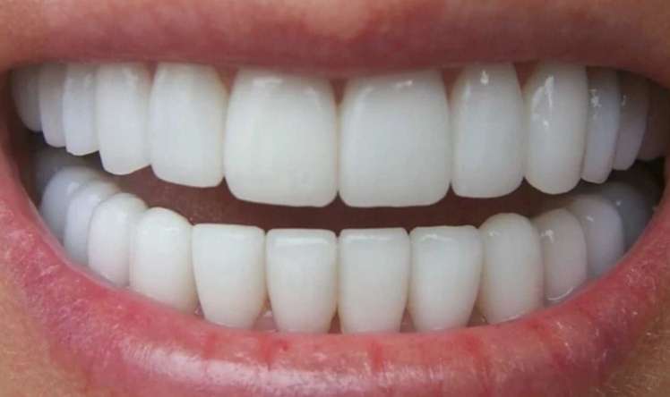 Niyə 32 dişimiz var? 