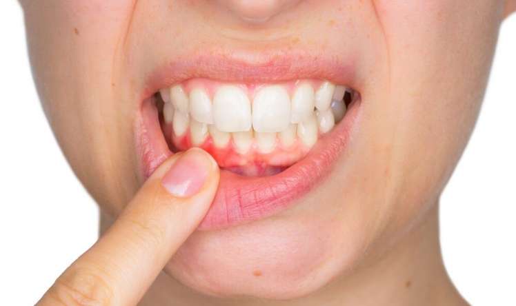 Diş problemləri təkcə ağız boşluğu ilə  məhdudlaşmır