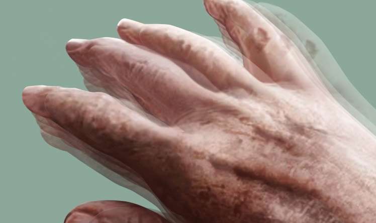 7 il Parkinson xəstəliyi ilə yaşayan pasiyentin mübarizə hekayəsi -  VİDEO
