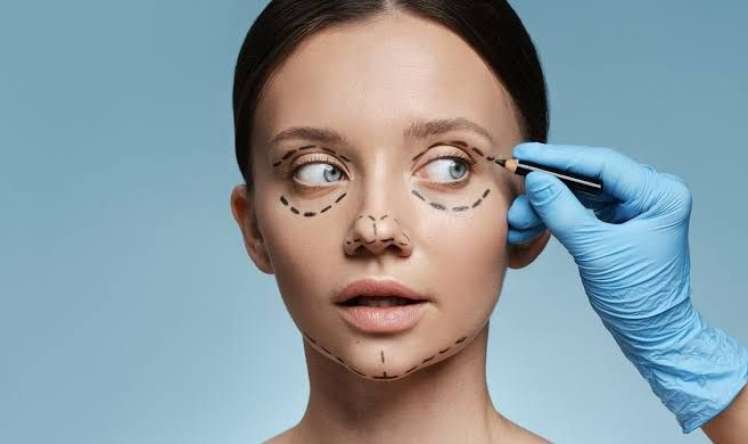 Gözaltı blefaroplastikanın  risklərini çoxu bilmir  – Həkim