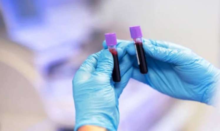 Vazopressin nədir? -  Kişilərdə vazopressin hormonu