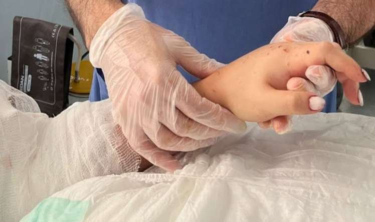 Bakıda qızın qopmuş qolu yerinə bərpa olundu -  FOTO